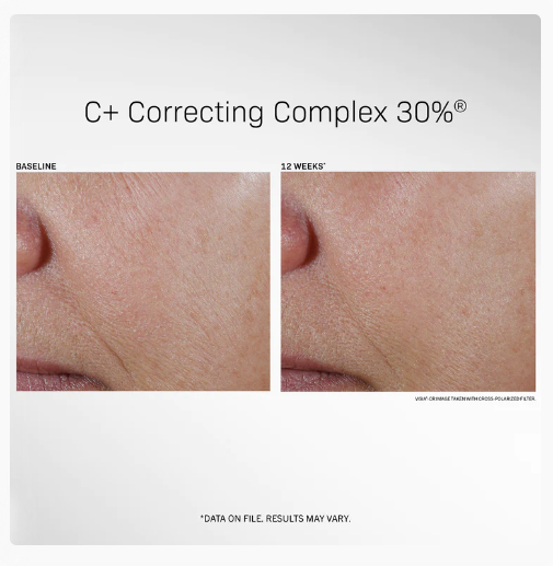 C+ Correcting Complex 30%® 1 fl oz REVISION